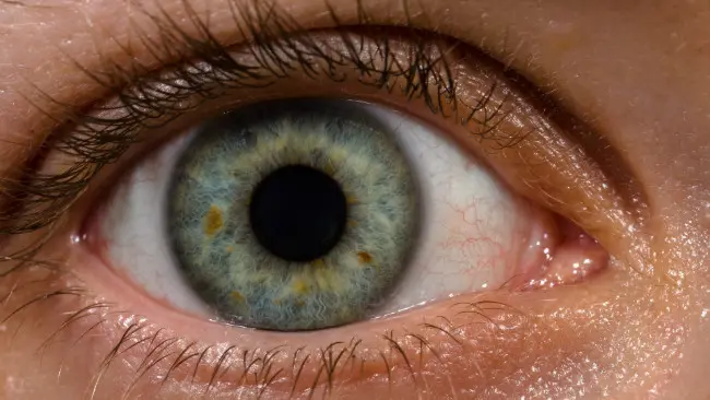Ilustrasi mata manusia. Tampak cincin limbal mengelilingi bagian iris mata. (Sumber Wikimedia Commons)