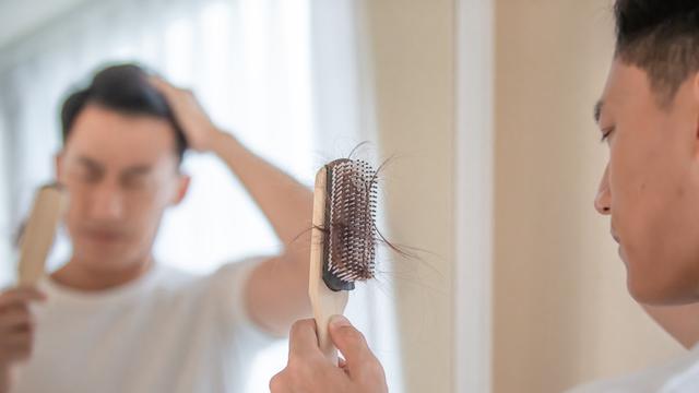Rambut Menipis pada Pria, Apa Sih Penyebabnya? Waspadai Risiko Kebotakan, Temukan Solusinya!