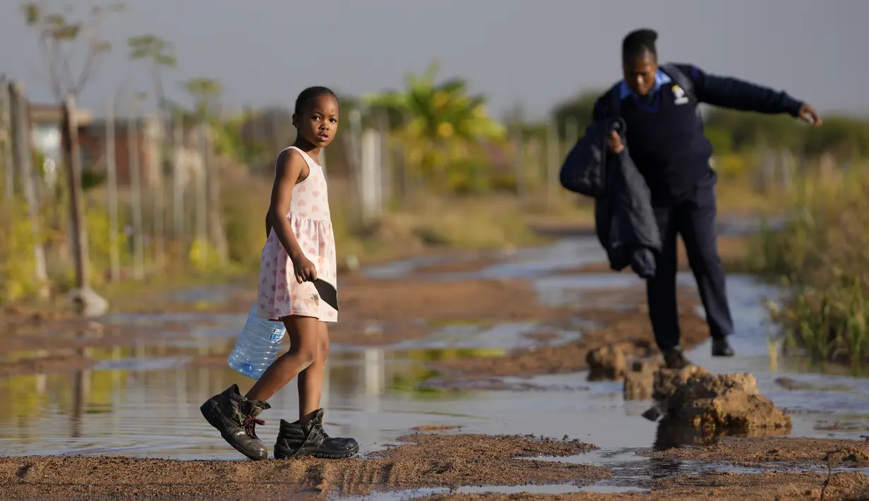 Sementara kasus-kasus yang tercatat di Zimbabwe dan sedikitnya 12 negara Afrika lainnya membuat para pejabat bersiaga. (AP Photo/Themba Hadebe)