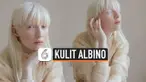 THUMBNAIL KULIT ALBINO