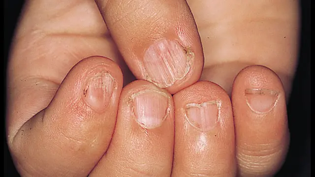 9 Tanda ada yang Tak Beres dengan Tubuh