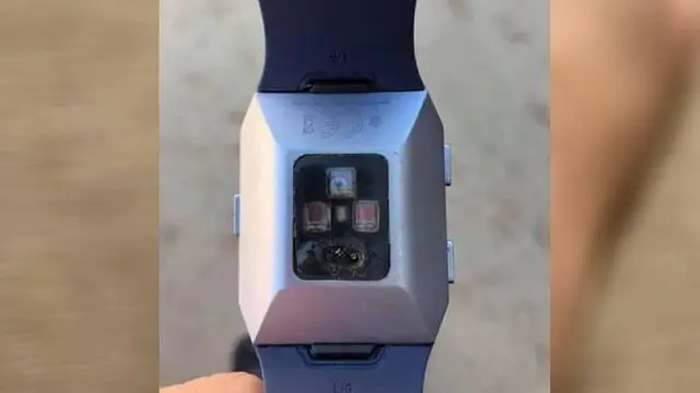 Jam Tangan Pintar Fitbit Meledak di Lengan. Dok: Facebook