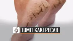 Tumit kaki pecah-pecah bisa disebabkan perubahan hormon. Serta faktor lingkungan bahkan beberapa hal lain.