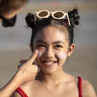 Kulit yang sebelumnya terpapar sinar matahari dan udara panas bisa kehilangan kelembaban dan menjadi kering. Foto: Document/ApotekWellings