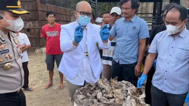 Dokter Arso menjelaskan hasil pemeriksaan terkait temuan kafan berisi tulang