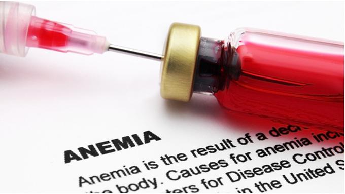 Penyebab Sakit Anemia Pada Wanita - Beauty Fimela.com
