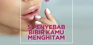 Apa sih penyebab bibir menghitam? Yuk, cek faktanya!