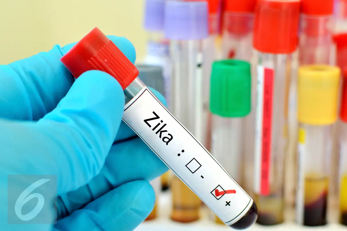 Virus Zika