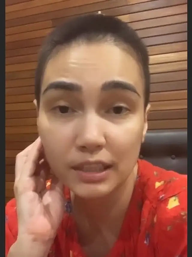 6 Potret Terbaru Feby Febiola Usai Jalani Kemoterapi, Kini Botak