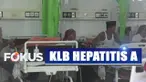Meningkatnya kasus hepatitis A terjadi sejak dua pekan terakhir.
