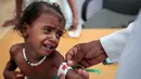 Dokter mengukur lengan gadis malnutrisi di Pusat Kesehatan Aslam, Hajjah, Yaman (1/11). PBB melaporkan setidaknya 3,5 juta mungkin masuk ke tahap pra-paceklik. Malnutrisi, kolera, dan penyakit epidemi lainnya seperti difteri. (AP Photo / Hani Mohammed)