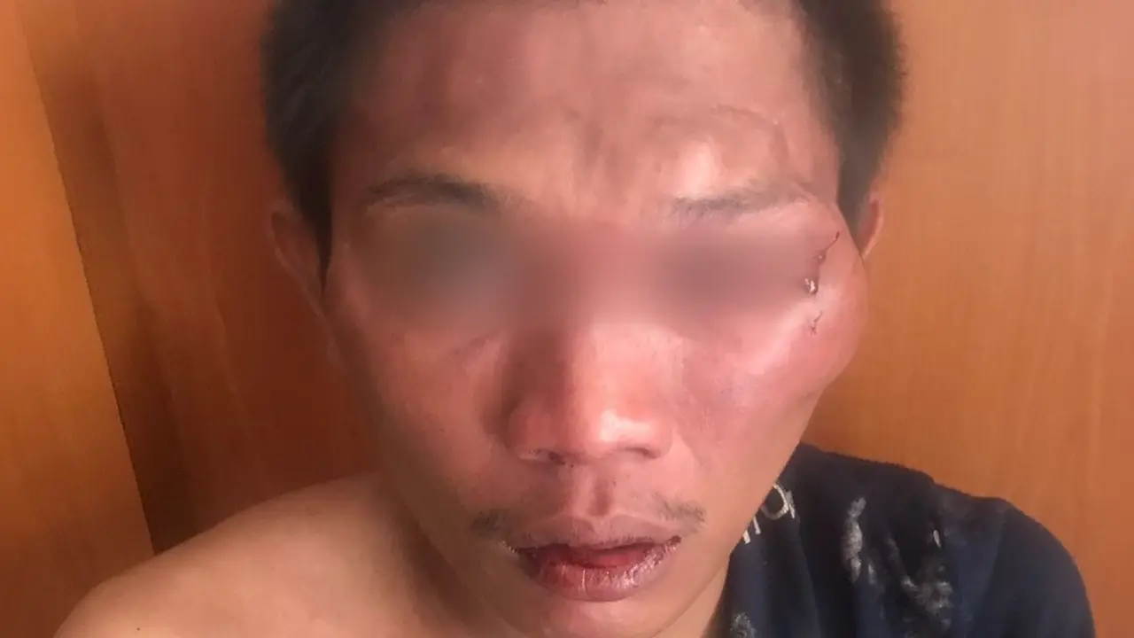 Seorang pemuda babak belur diamuk massa setelah kepergol mencuri sepeda motor yang terpakir di Jalan KH H Muhdam, Palmerah Jakarta Barat (Istimewa)