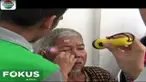 Sebelum operasi mereka menjalani pemeriksaan kesehatan awal. Hasilnya, 90 pasien lolos seleksi dan mendapatkan operasi katarak secara cuma-cuma.