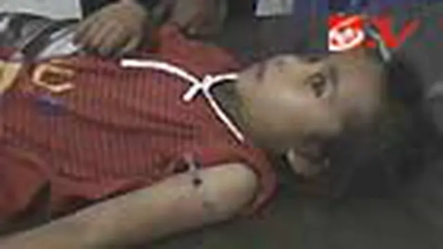 Bocah Tertembak Senapan Angin