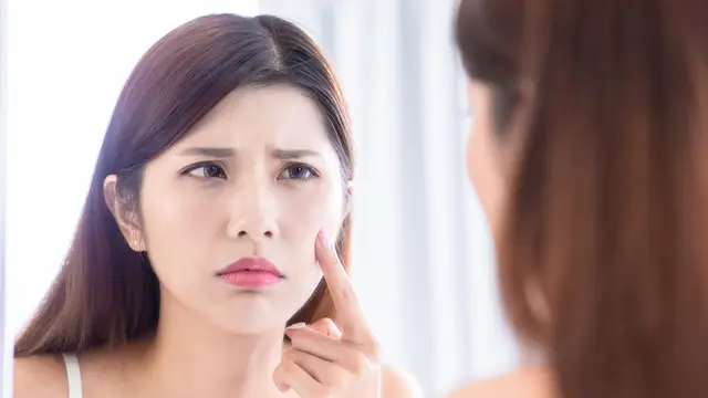 Makanan Manis Memang Enak, Tapi Yakin Sudah Tahu Efeknya pada Kulit?