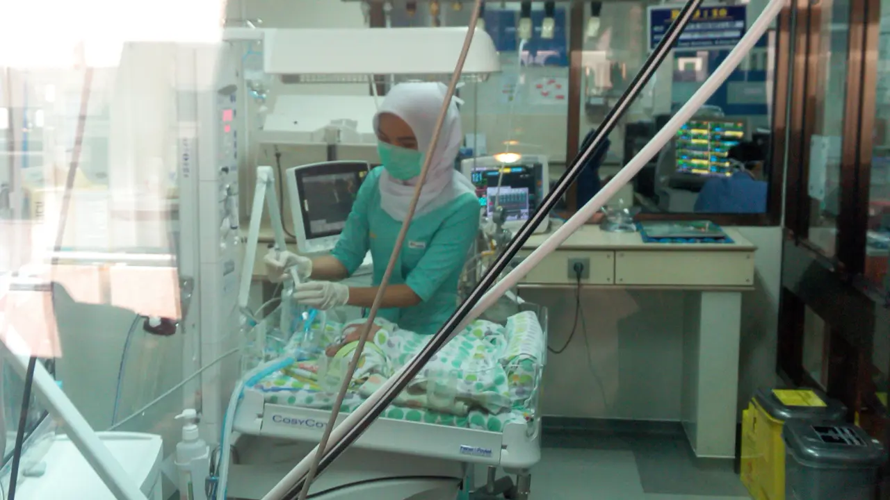 Bayi kembar siam