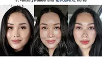 Setelah satu bulan, Titi DJ membagikan potret terbaru wajahnya yang telah melalukan operasi anti aging. (@ti2dj)