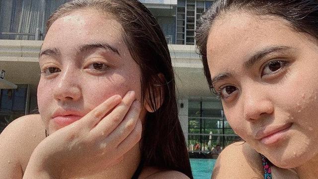 Tak Kalah Cantik, Ini 6 Potret Rania Marchella Adik Ranty Maria