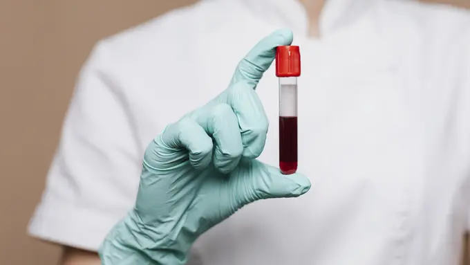 Ilustrasi virus Nipah