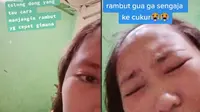 Tak Sengaja Tercukur, Rambut Bagian Depan Wanita Ini Jadi Botak. (Sumber: TikTok/ @onananaa0)