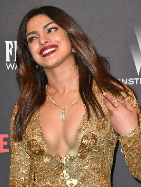 Tersiar kabar, sampai saat ini Priyanka masih menjalani perawatan intensif di rumah sakit guna mengembalikan kondisinya agar semakin membaik. Meskipun begitu, ia tetap meyapa penggemarnya lewat media sosial. (AFP/Bintang.com)