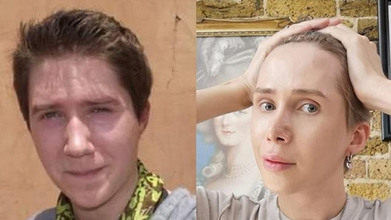 pria inggris operasi plastik agar mirip idol Korea