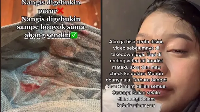 Dipukul Kakaknya Sampai Babak Belur, Kondisi Wanita Ini Bikin Pilu