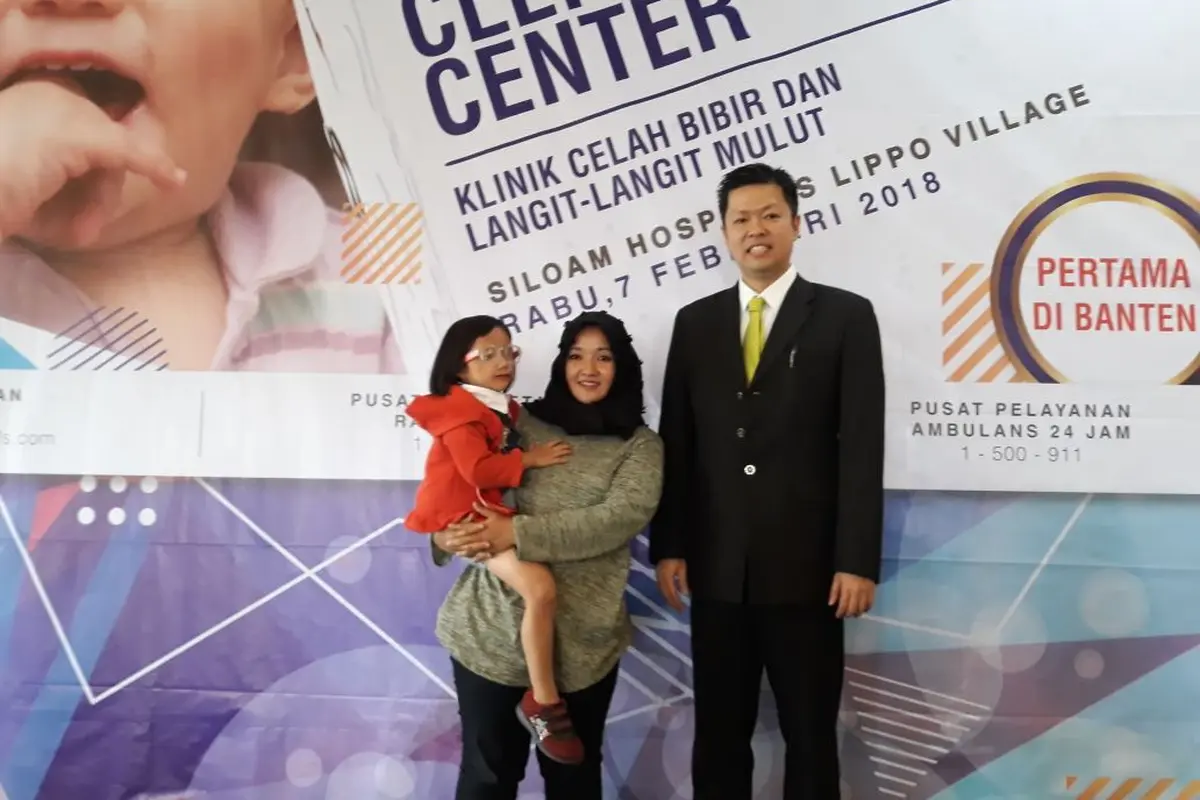 Bibir Sumbing