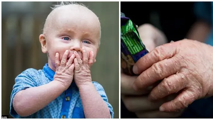 Foto : copyright dailymail.co.uk