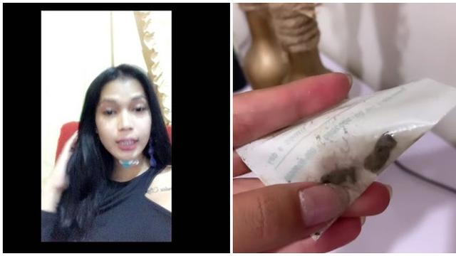 6 Potret Terbaru Dinda Syarif Usai Operasi Penghilangan Jakun, Curi Perhatian