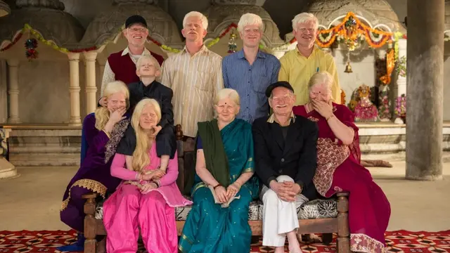 Potret Keluarga Paling Unik di Dunia, dari Albino Hingga Kurcaci