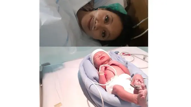 6 Seleb yang Pernah Alami Gangguan Kesehatan Saat Hamil, Terbaru Mirror Syndrom Irish Bella