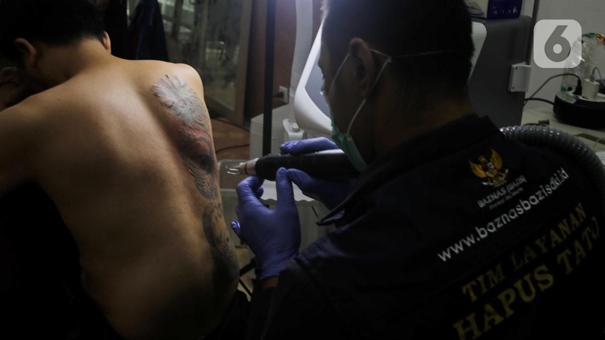 Masuk Tahun Keenam, Layanan Hapus Tato Ramadan Targetkan 700 Orang