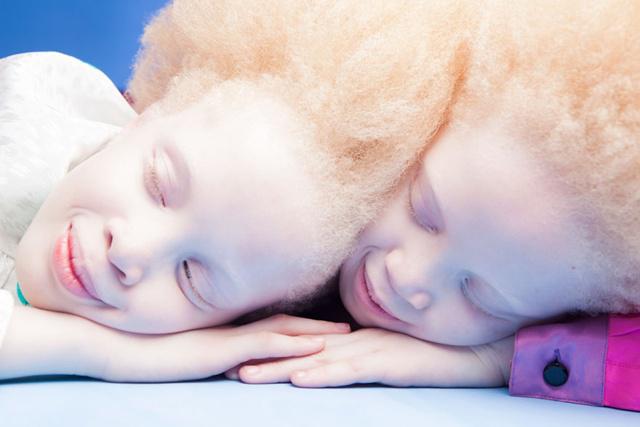 Lara dan Mara adalah model kembar dengan kondisi albino | Photo: Copyright boredpanda.com