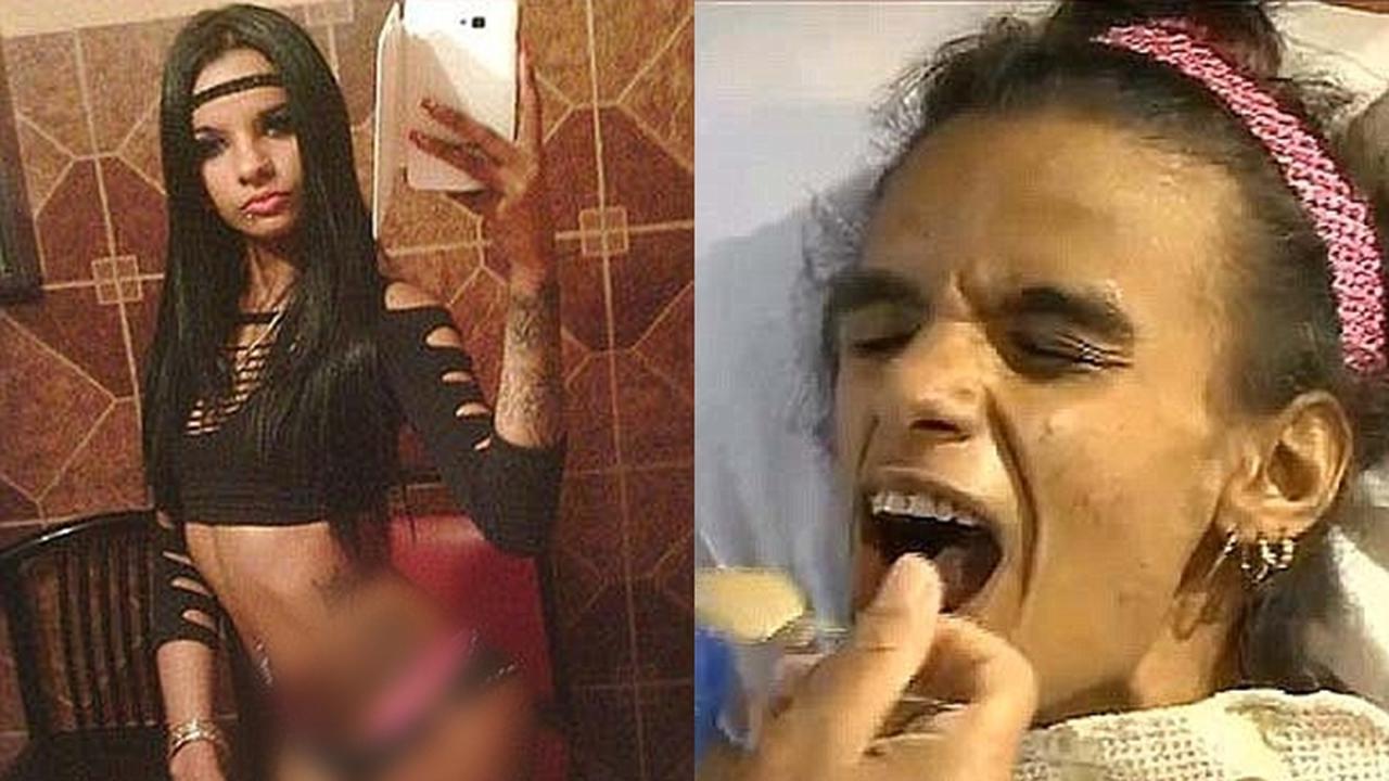 Implan Payudara Gagal, Wanita Ini Malah Jatuh Koma