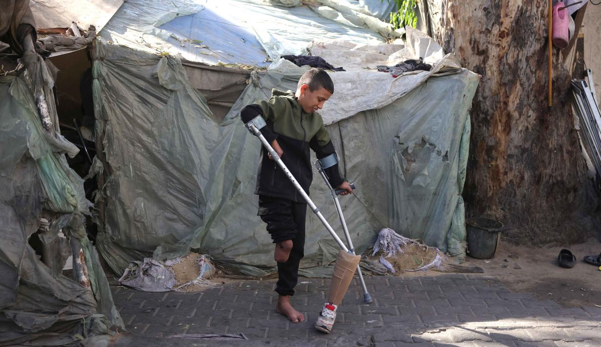 Ketika itu, Rateb Mahmoud Qaliq bersama ibu dan saudara lakinya hendak mengunjungi tenda kakeknya, namun sebuah mobil di dekatnya meledak akibat serangan udara militer Israel. Tampak dalam foto, Rateb Mahmoud Qaliq menggunakan kruk di halaman sekolah UNRWA yang telah menjadi tempat penampungan bagi pengungsi Palestina di Deir al-Balah, di Jalur Gaza tengah, pada 3 Desember 2025. (Bashar Taleb/AFP)