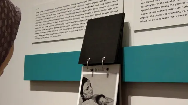 Sebuah foto menunjukkan ibu dan anak yang terkena cacar api sebelum ada vaksin, dipajang di museum Bio Farma (Liputan6.com/Giovani Dio Prasasti)