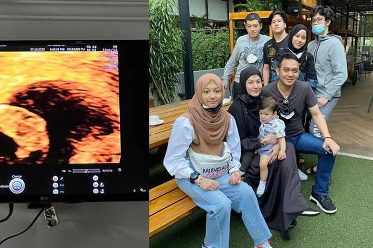 Alami Keguguran, Ini 6 Momen Kompak Lyra Virna Bersama Buah Hati