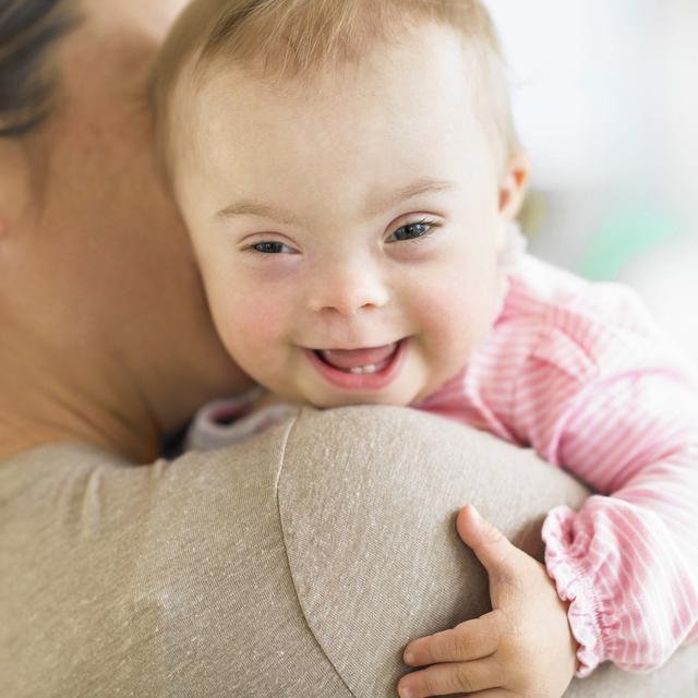 6 Pelajaran Hidup Membesarkan Anak Dengan Down Syndrome Health Liputan6 Com