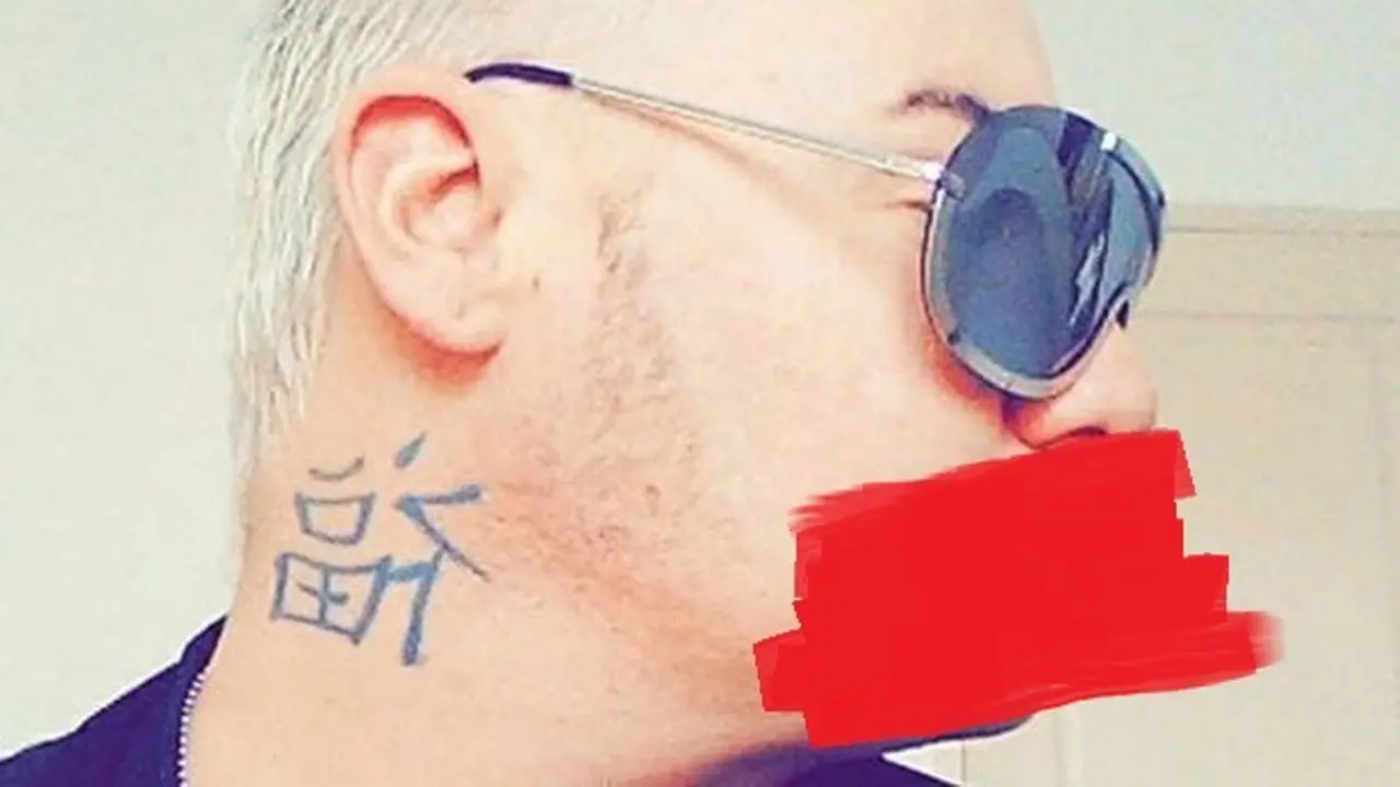 [Bintang] Sebelum Suntik Botox Cowok Ini Ganteng, tapi Sekarang Wajahnya...
