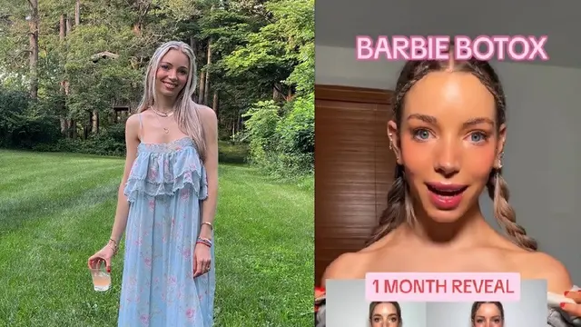 Barbie Botox, Tren Kecantikan Viral Agar Leher Jenjang dan Ramping