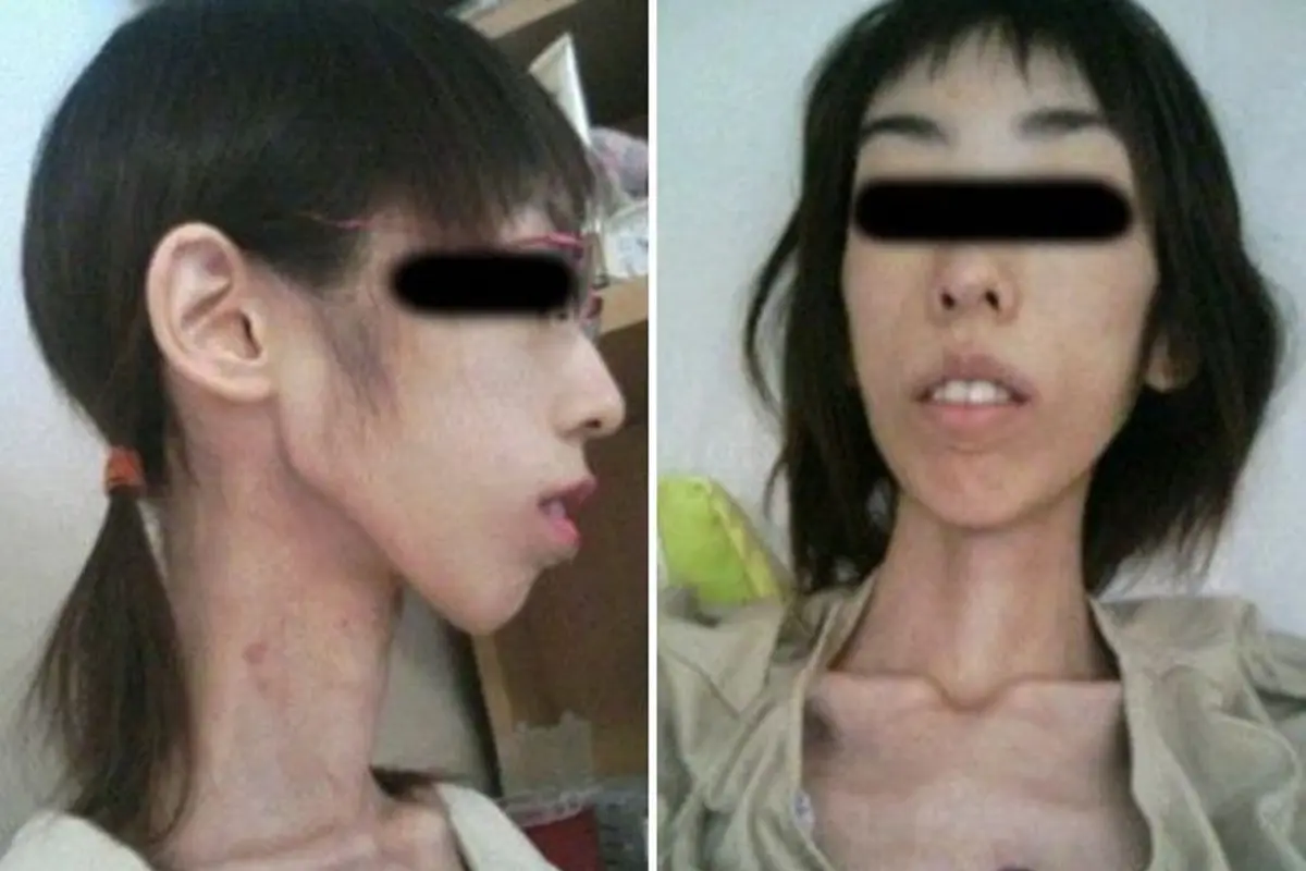 [Bintang] Disiksa Kakeknya Selama 10 Tahun, Kondisi Wanita Ini Memprihatinkan