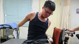 Huang Po - wei saat melakukan sesi rehabilitasi di pusat pemulihan di Taipe, Taiwan, (26/1/2016).Pria 23 tahun ini harus merelakan kaki dan tangannya di amputasi agar terhindar dari infeksi lukanya saat terjadi ledakan tersebut.(SAM YEH / AFP)