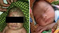 Bayi berjenis kelamin perempuan ditemukan warga. Foto: (Ola Keda/Liputan6.com)