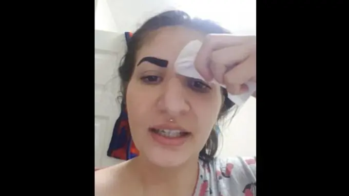 [Bintang] Kasihan tapi Lucu! Nggak Teliti Baca Aturan Pakai, Wanita Ini Malah Kehilangan Alisnya