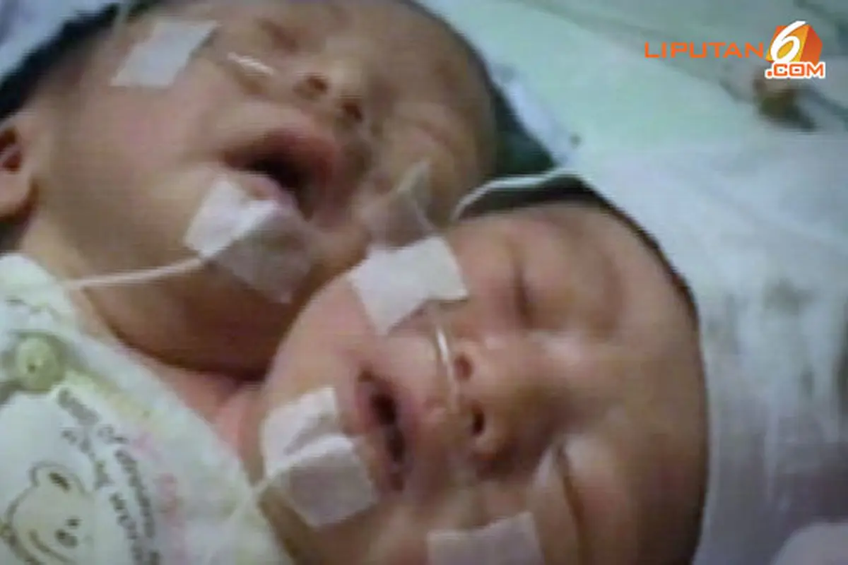 bayi-2-kepala130629c.jpg