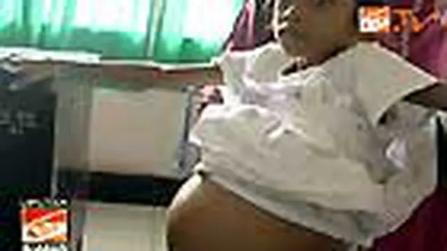 Tumor Ganas Bersarang di Perut Bocah
