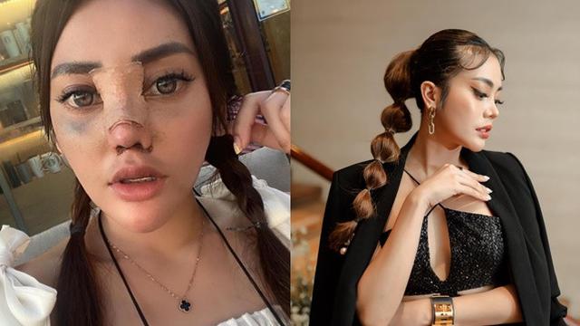 6 Potret Seleb Jalani Operasi Plastik di Tahun 2022, Penampilannya Bikin Pangling (sumber: Instagram/)