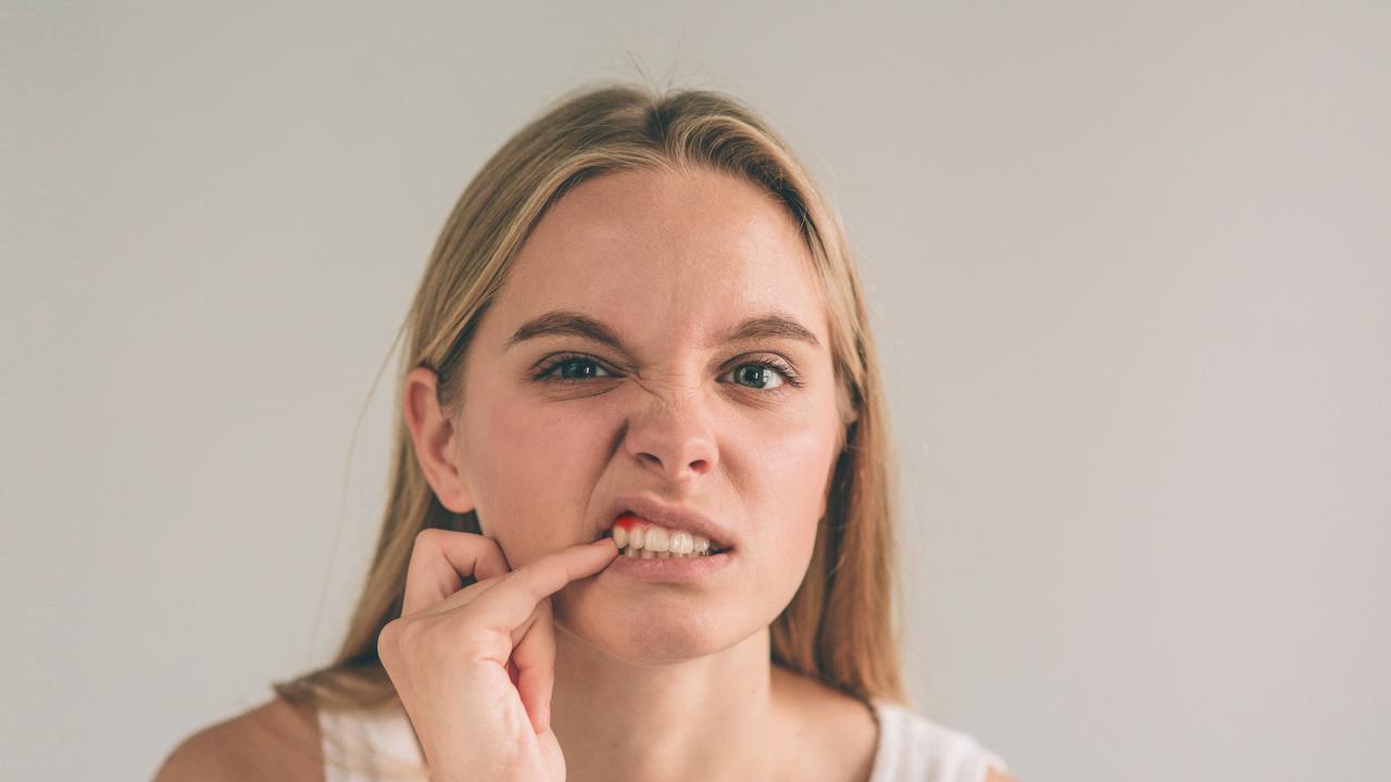 Penyebab Gusi Berdarah