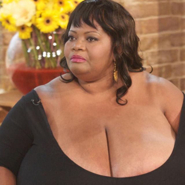 Foto Foto Norma Stitz Wanita Dengan Payudara Terbesar Di Dunia Health Liputan6 Com